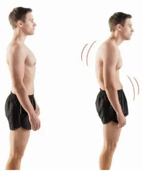 5 dicas para evitar Hipercifose "Acabe com a corcunda" Dr. Gregory G Markarian, MD