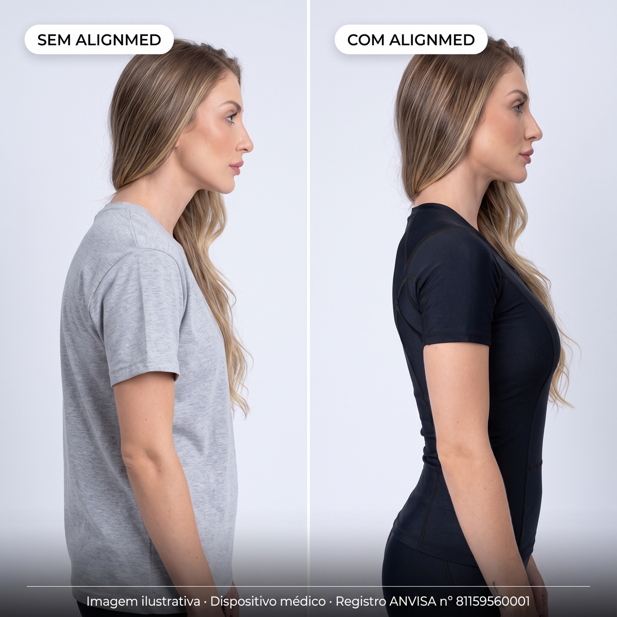 Comparativo sem AlignMed e com AlignMed: postura curvada e, com a Camiseta Postural Feminina Pullover, ombros para trás e coluna neutra. Imagem ilustrativa.