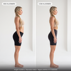 Comparativo sem AlignMed e com AlignMed: quadril inclinado para frente e lombar sobrecarregada e, com a Bermuda de Ciclismo Postural, pelve neutra e quadril alinhado. Imagem ilustrativa.