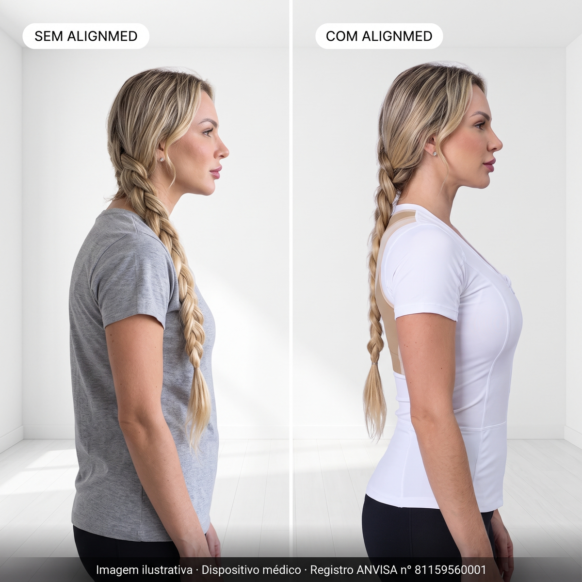 Comparativo sem AlignMed e com AlignMed: postura curvada e, com a Camiseta Postural Feminina com zíper, ombros para trás e coluna neutra. Imagem ilustrativa.